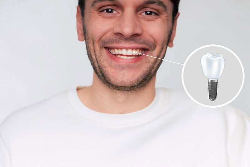 Restore Your Perfect Smile with Dental Implants at International Moral Dental